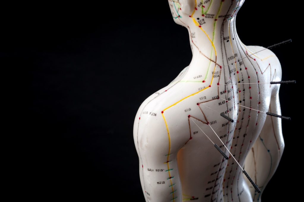 The long-term benefits of acupuncture come from a realignment of your body's energy.